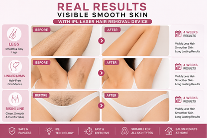 IPL Laser Hair Removal Device